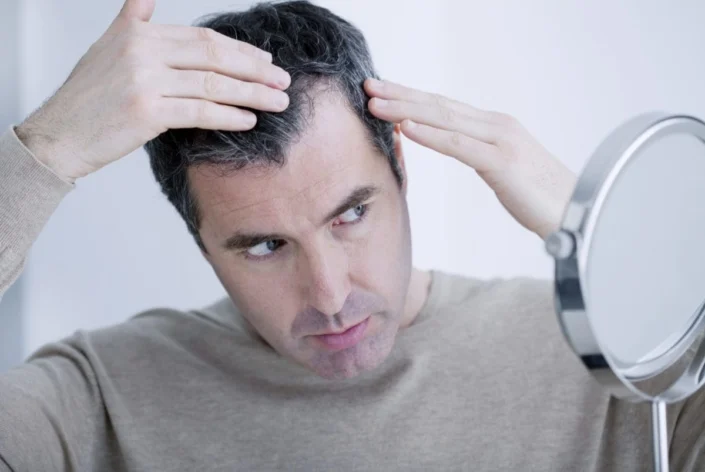 Come usare l'estratto di Saw Palmetto per la caduta dei capelli?
